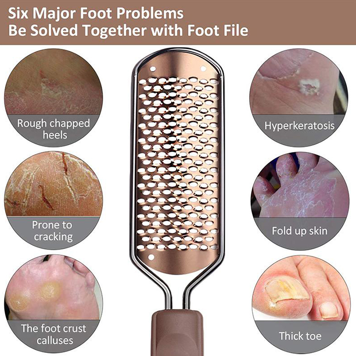 FootFile, η απόλυτη λίμα χειρός για πεντικιούρ - Image 9
