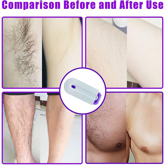 SmoothTouch, πολυχρηστική ξυριστική μηχανή για γυναίκες - Image 7