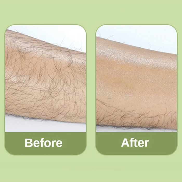 SoftSkin, ένα κρυστάλλινο αποτριχωτικό που αφαιρεί την τρίχα και επιβραδύνει την ανάπτυξη τους - Image 5