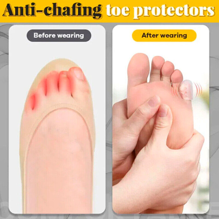 ToeProtector, προστατευτικό δαχτύλου σιλικόνης (10 τεμάχια) - Image 5