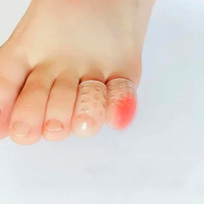 ToeProtector, προστατευτικό δαχτύλου σιλικόνης (10 τεμάχια) - Image 8